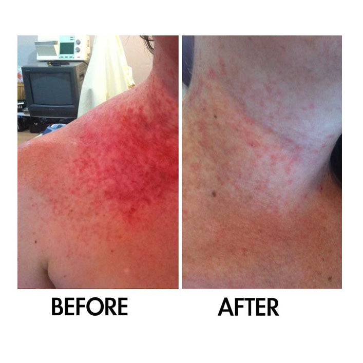 Derm 1™ Dry Skin Rescue with Vitamin B3 3.38 oz